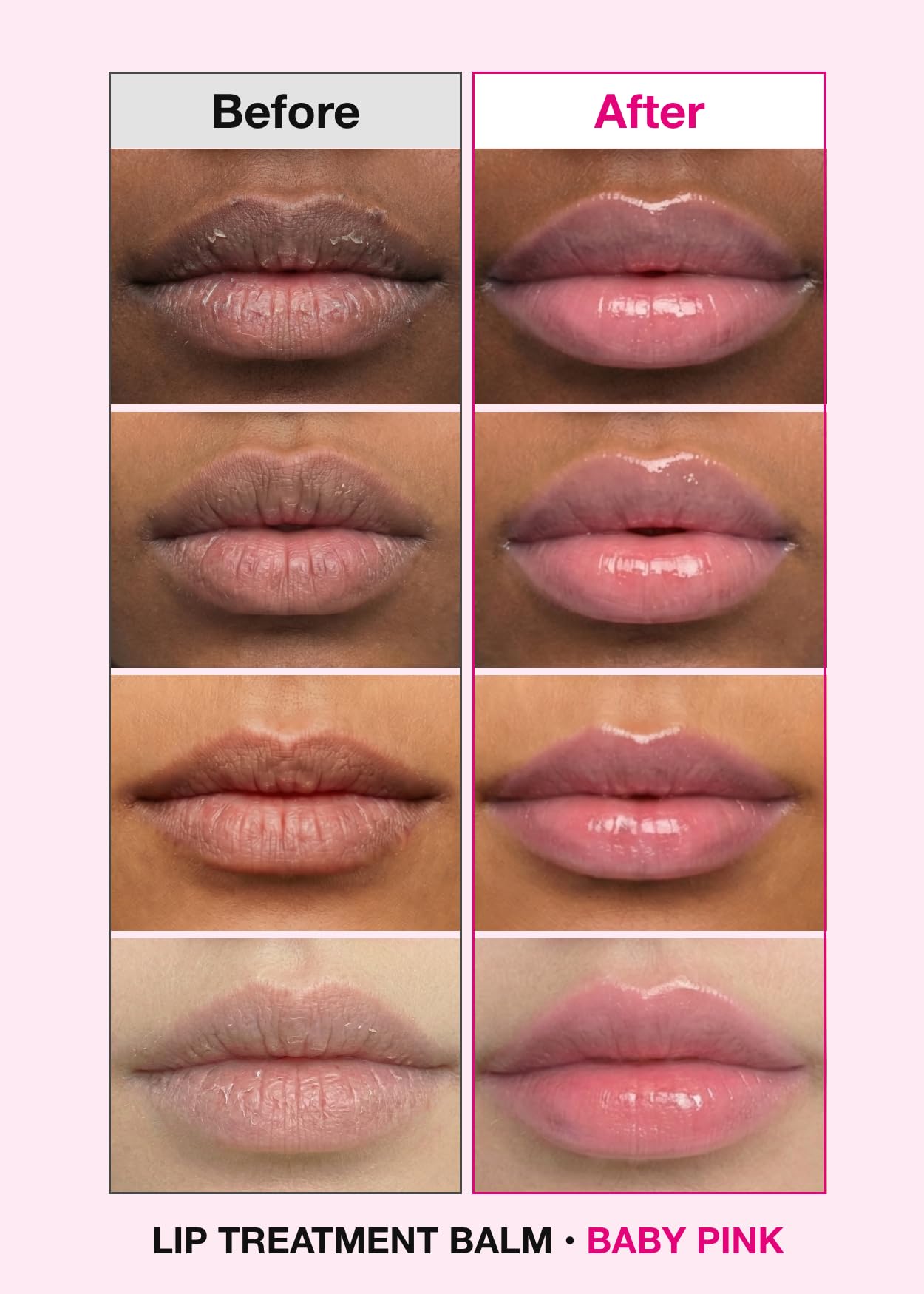 ISOI Bulgarian Rose Lip Treatment Balm (Baby Pink) – Hydrating & Tinted Lip Balm for Dry Lips, Korean Skincare (0.18 oz, 5g)