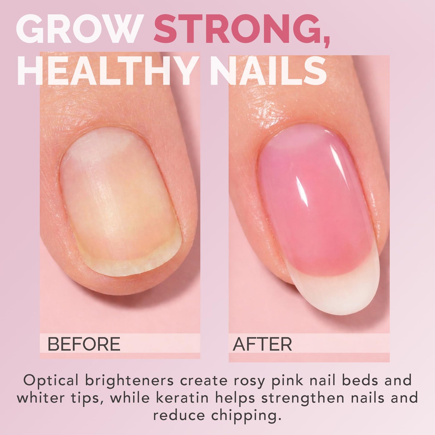 Perfect Formula Pink Gel Coat – Rosey Glow Nail Strengthener & Keratin Treatment, 0.6 oz - Protein-Rich, Glossy Pink Gel Nail Polish for Damaged Nails | Supports Growth & Repair