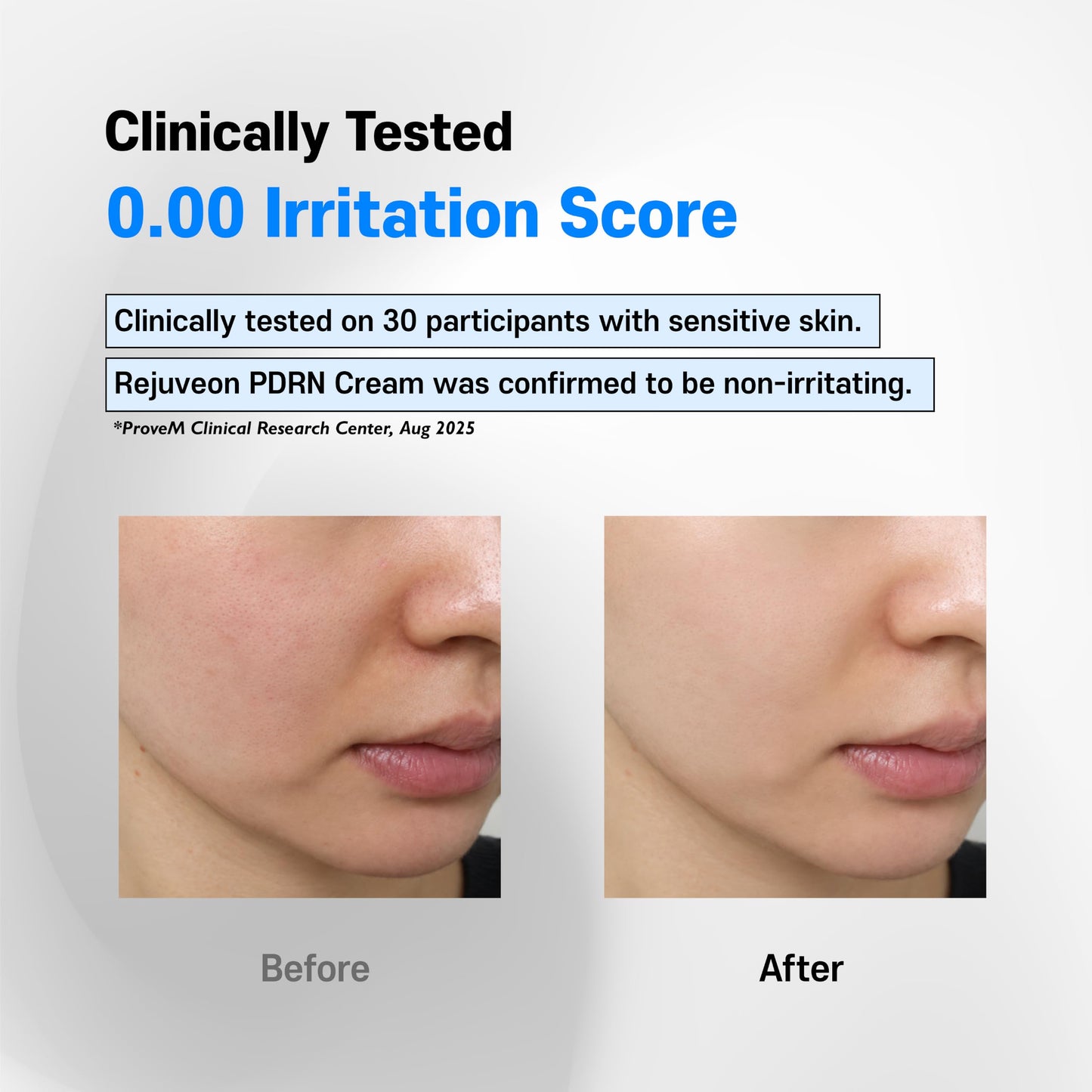 Rejuveon PDRN 1000 Plus Cream (Polydeoxyribonucleotide sodium) 20g - Made in Korea