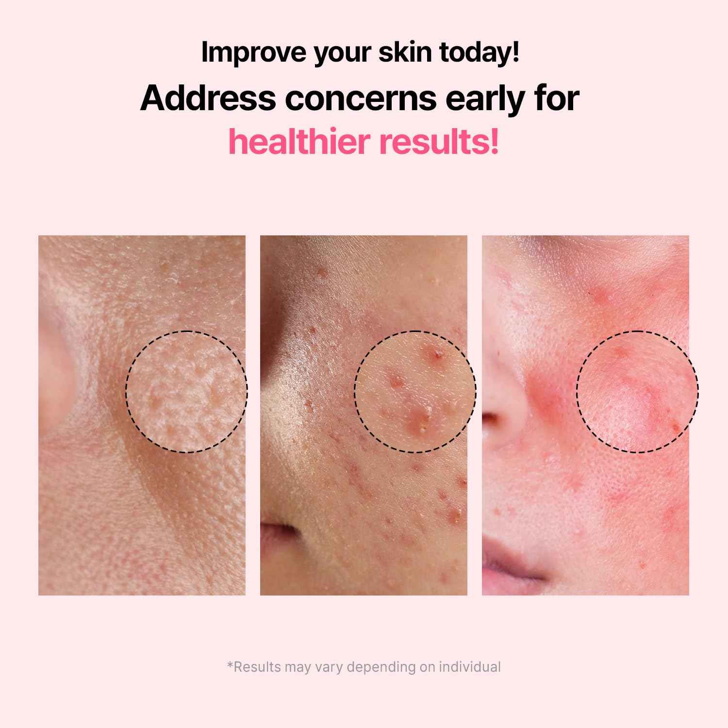 VEGANIFECT Pore Refining Ampoule, Pore Tightening, Reduce Sebum, Korean Skin Care, Vegan, 1.69 Fl Oz