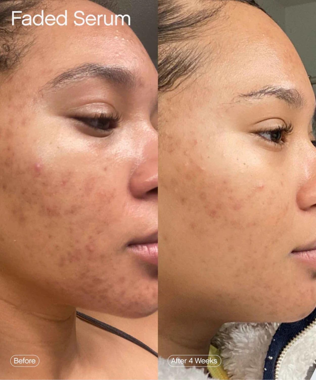 Topicals Faded Brightening Serum - Reduces Discoloration & Scars | Kojic Acid & Niacinamide | 1.7 Fl Oz