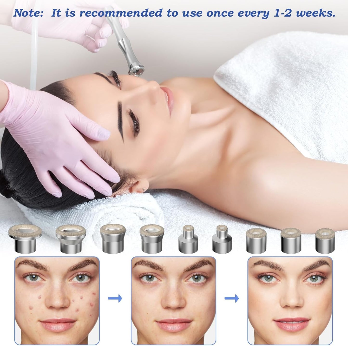 Diamond Dermabrasion Tips - Microdermabrasion Machine Accessories | 9 Replacement Tips & 3 Wands