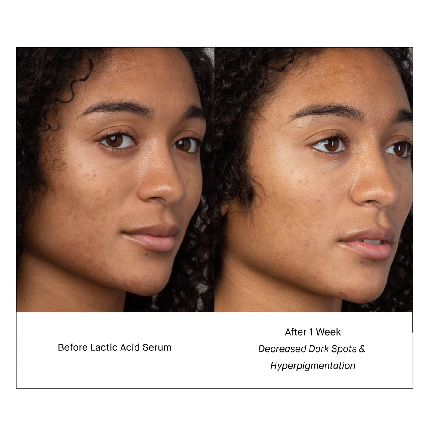 SHANI DARDEN SKINCARE Lactic Acid Face Serum Travel Size, Active PM Serum to Brighten and Smooth Skin, 0.34 fl oz