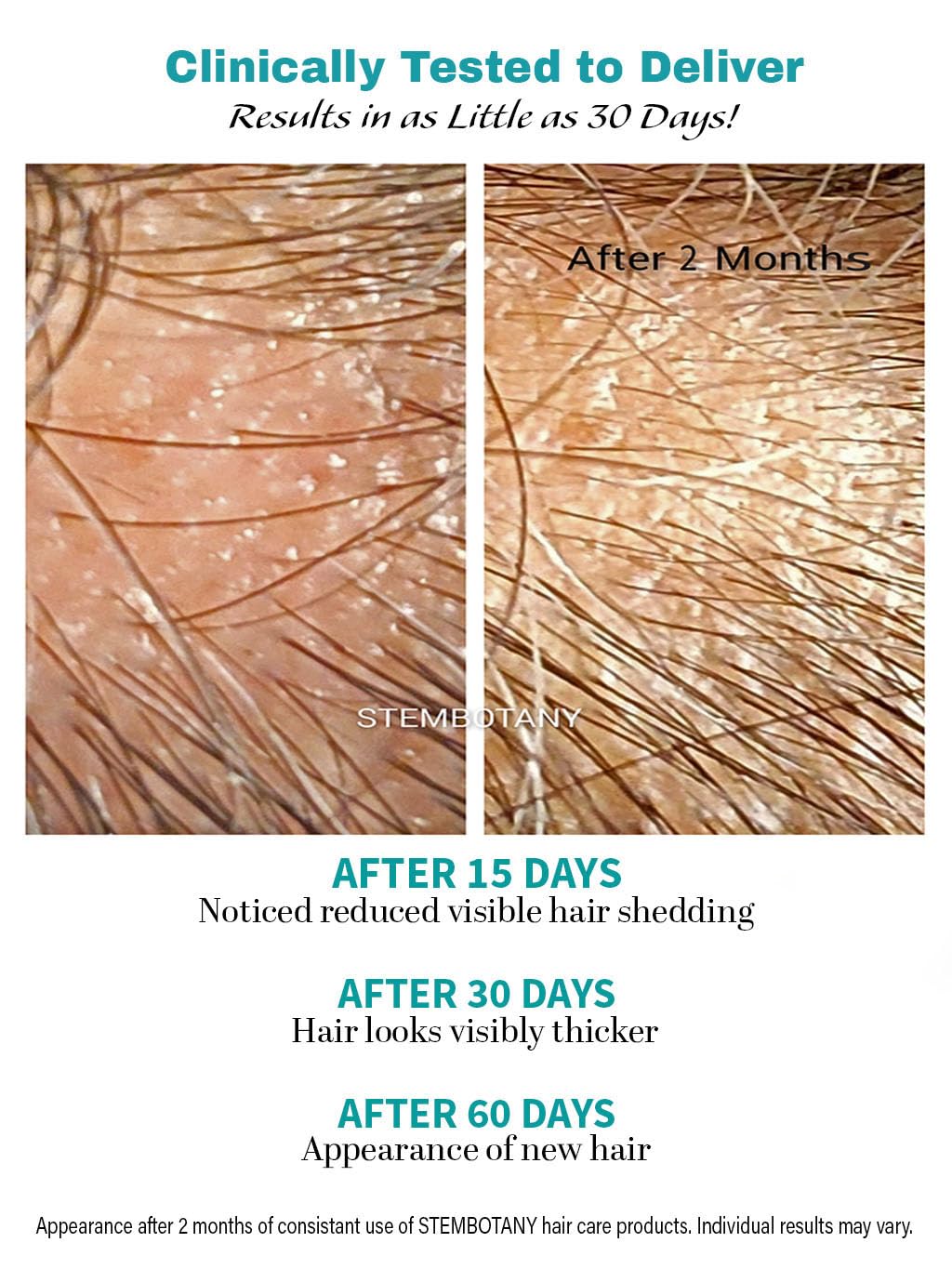 BIOCELLMED Copper Peptide Absolute GROW® Scalp Serum with Copper Peptides and Plant Stem Cells for Hair, 1.05 oz