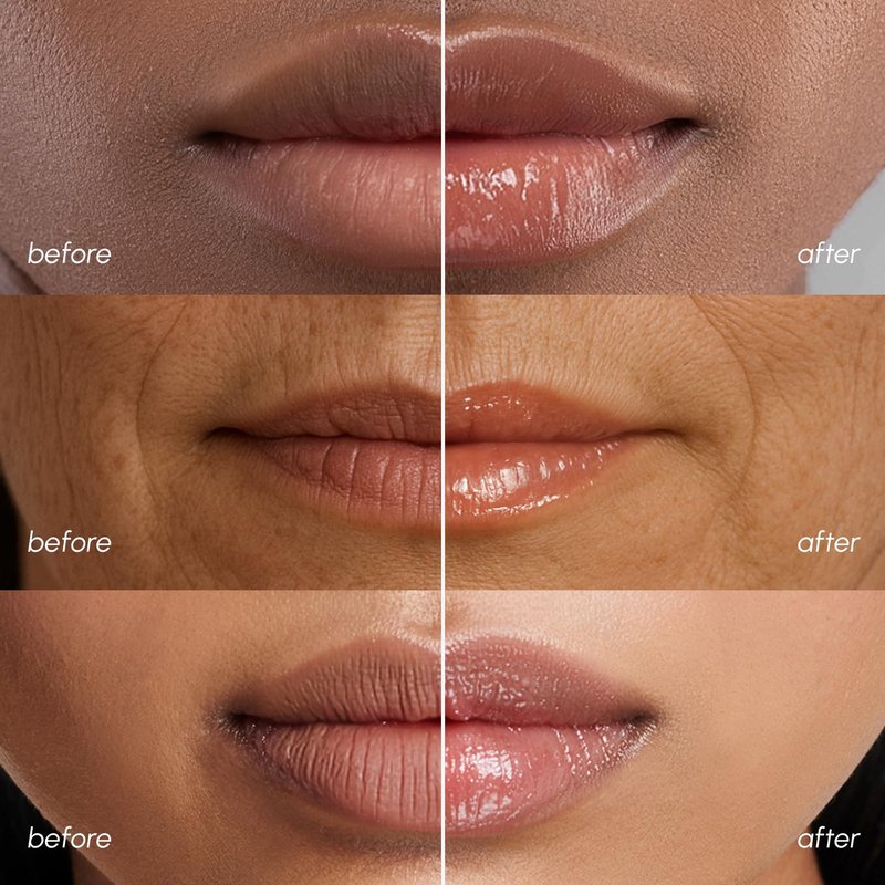 MAREE Lip Mask Overnight - Lip Moisturizer For Very Dry Lips - Hydrating Lip Butter Balm with Hyaluronic Acid & Collagen - Overnight Lip Treatment - Lip Sleeping Mask Repair - Hidratante de Labios