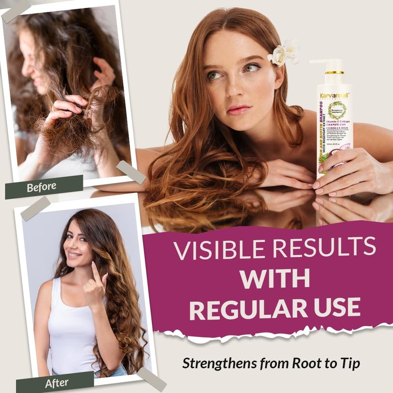 Rosemary Biotin Shampoo & Hair Mask Set | Onion Extract, Collagen & Vitamin E Anti-Thinning, Anti-Hairfall Shampoo and Deep Conditioner Set for Dry, Damaged Hair, Sulfate & Paraben Free 2 x 16.9 fl oz
