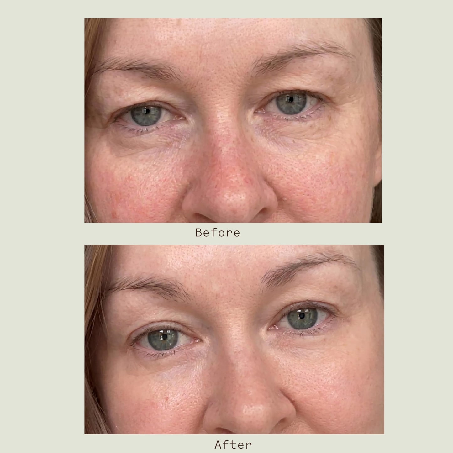 Matter of Monday Under Eye Cream for Dark Circles with Caffeine & Peptides, Firming, Anti-Fatigue for Puffiness & Fine Lines, Sensitive Skin, 0.5 oz