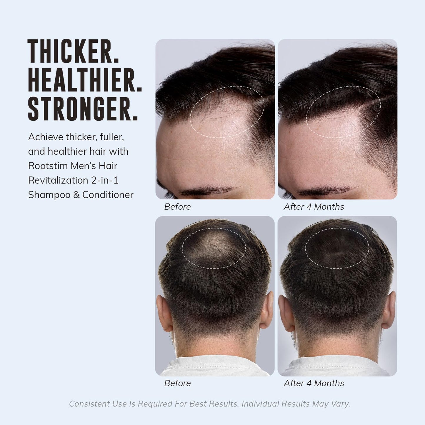 DHT Blocking Shampoo for Men | Hair Thickening & Anti-Hair Loss Formula with Biotin & Saw Palmetto - 10oz, Sulfate-Free