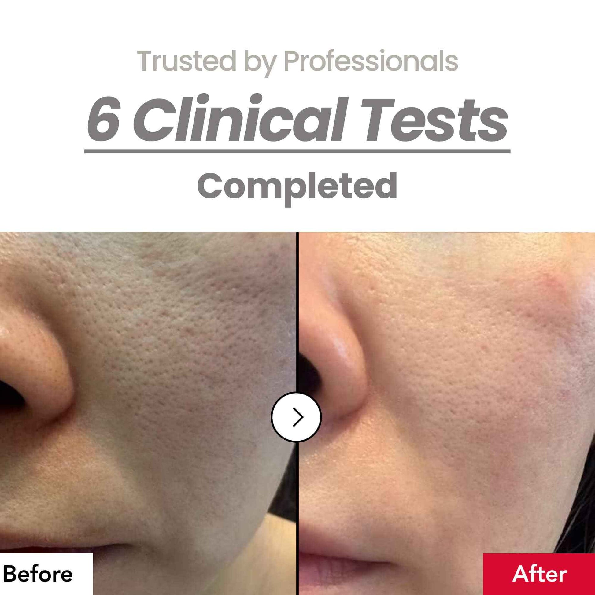 Dr.Percent Pore 55% Skin Texure Pad – AHA BHA LHA, Retinol & Rice Extract for Enlarged Pores, Textured Skin, Sebum Control, Exfoliating Toner Pads for Glass Skin, Non-Irritating, Korean Skincare(60ct)