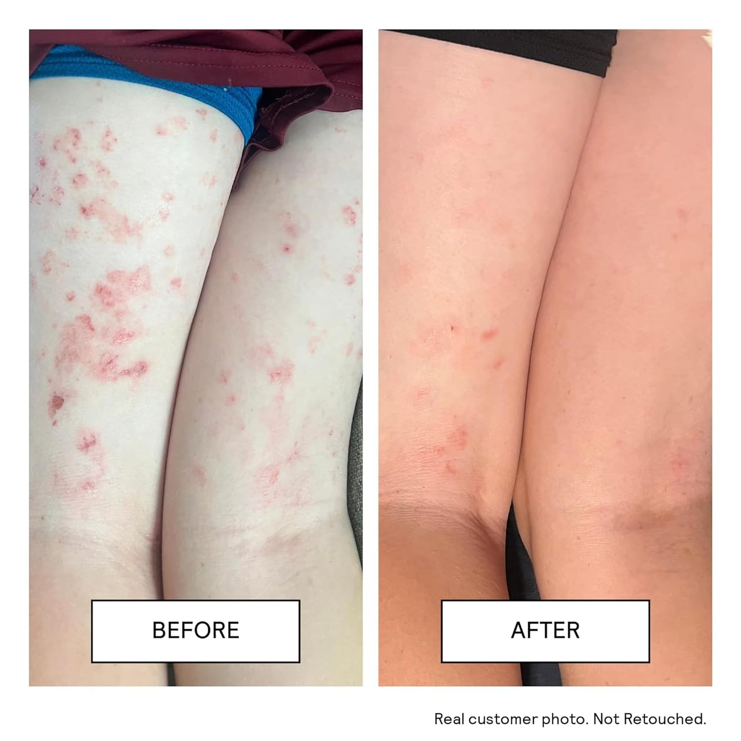 Untoxicated Moisturizing Cream - Facial Moisturizer & Body Cream for Sensitive Skin and NEA Approved for Eczema Relief - Ceramides & Hyaluronic Acid with No Common Irritants