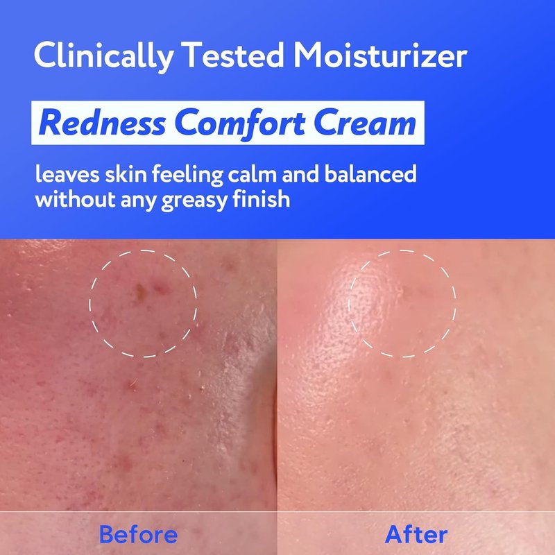 SOONDING Coconut Hydro Barrier Cream | Soothing & Barrier Repair Moisturizer with Panthenol, Ceramide & Squalane | Non-Greasy, Fragrance Free Capsule Cream Korean Skin Care (80ml / 2.7 fl oz)