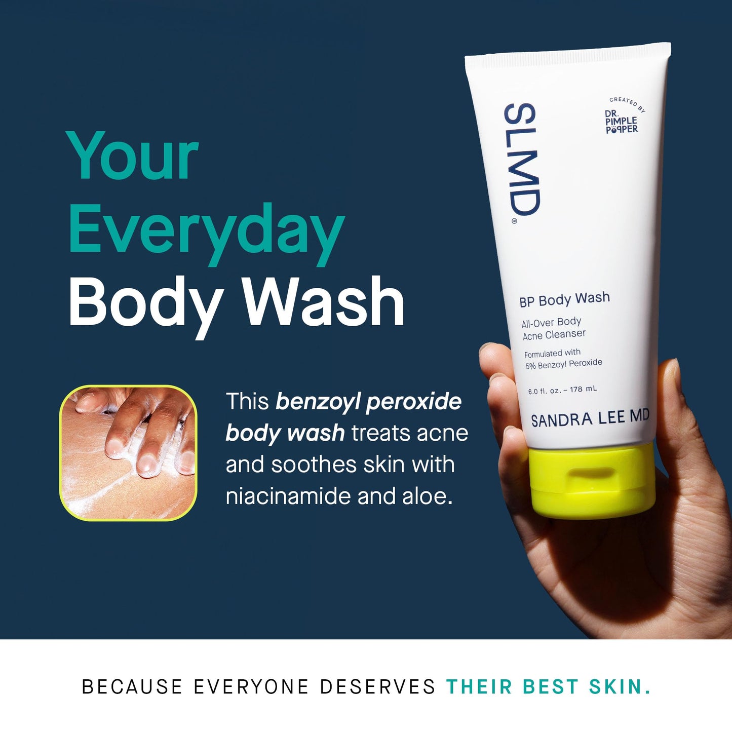 SLMD by Dr. Pimple Popper BP Body Wash – 5% Benzoyl Peroxide Exfoliating Cleanser for Clearer, Smoother-Looking Skin – 6 fl. oz Skincare