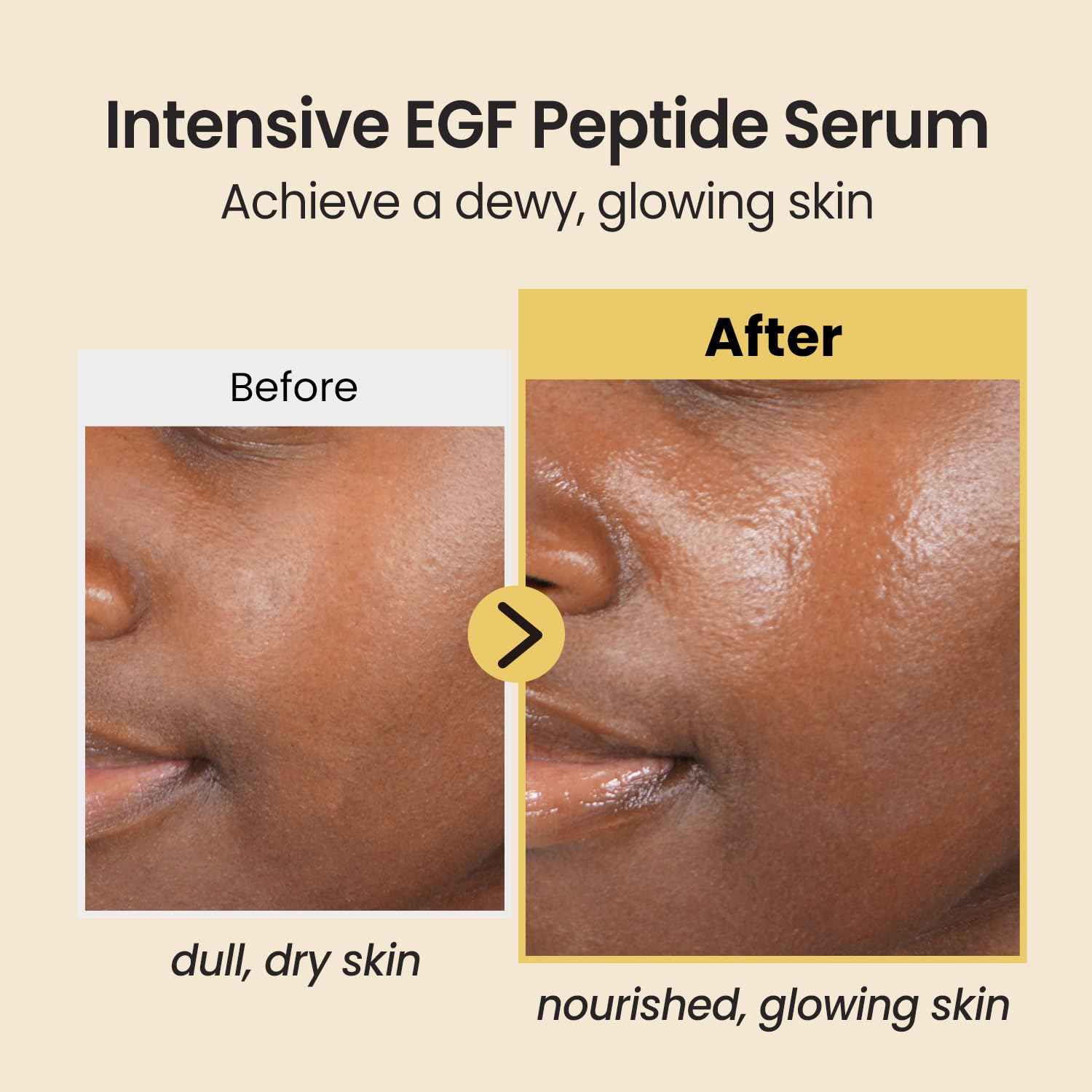 coxir INTENSIVE EGF PEPTIDE SERUM l EGF, Peptide, Niacinamide, Collagen l Firming l Korean Skincare (1.69 Fl Oz (Pack of 1) + 0.23 Fl Oz (Pack of 1))