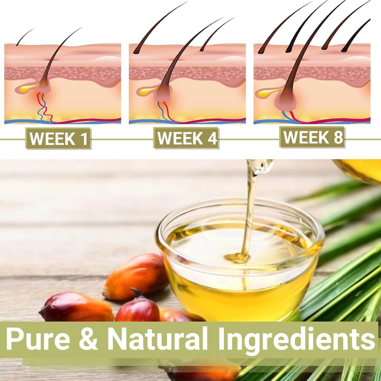 Lifewitqueenp Hair Care Growth Oil, Queenp Ayurvedic Hair Growth Oil, Lightweight for All Hair Types (1pcs)