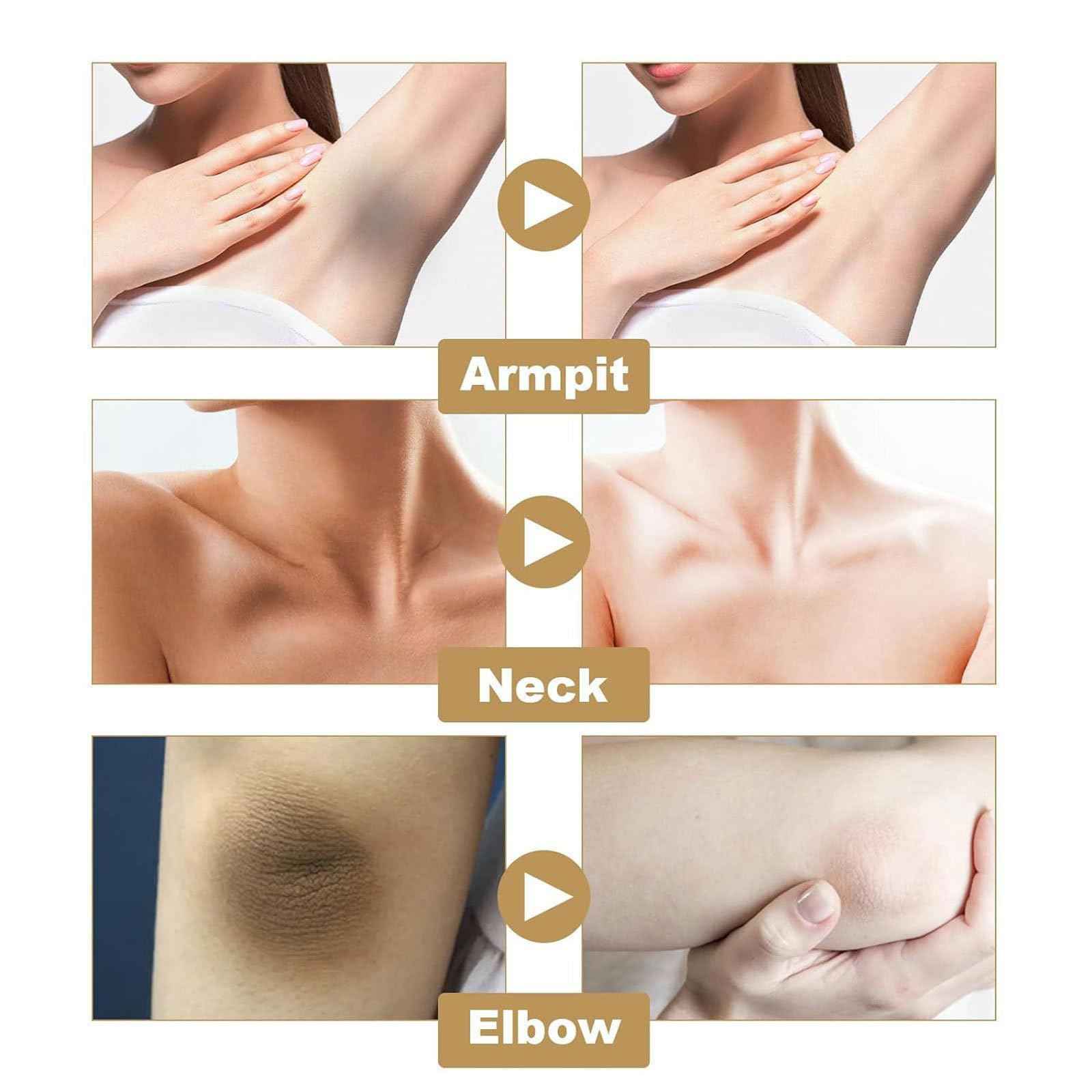 Body Lotion Crema Aclaradora, Moisturizing, Hydrating Bodys Lotions, Lightweight & Non-greasy, For Body, Face, Underarms, Knees & Elbows (2pcs, 3.5fl oz)