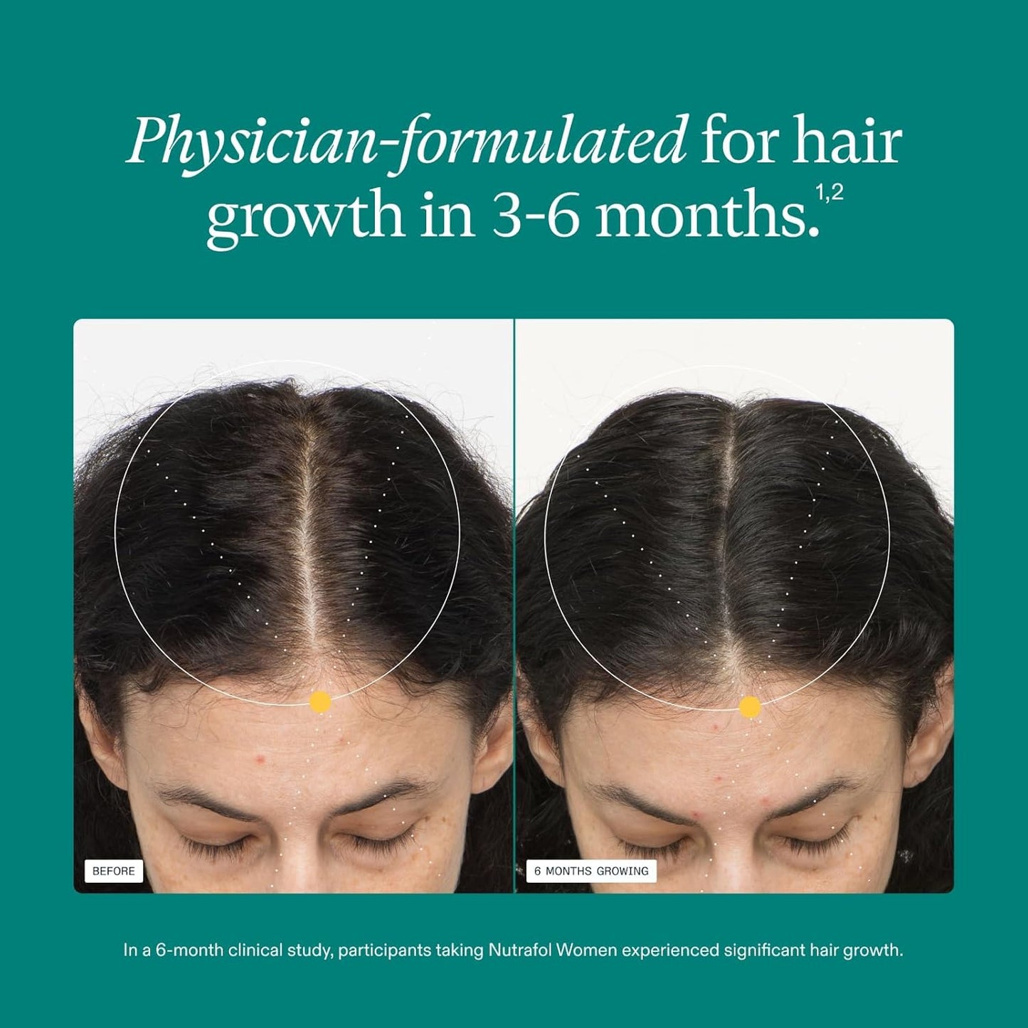 Nutrafol Women's Hair Growth Supplements - Clinically Tested for Thicker, Stronger Hair | 1 Month Supply, Ages 18-44