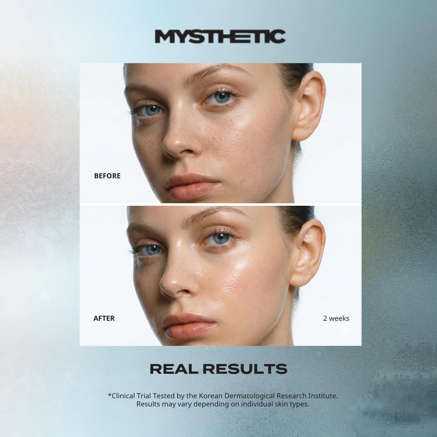 MYSTHETIC PDRN Collagen Wrapping Mask with CICA-PDRN Micro-Spicule Shots for Elasticity, Pore-Minimizing, Hydration, Glow - Korean Skin Care - 2.7 FL. OZ.