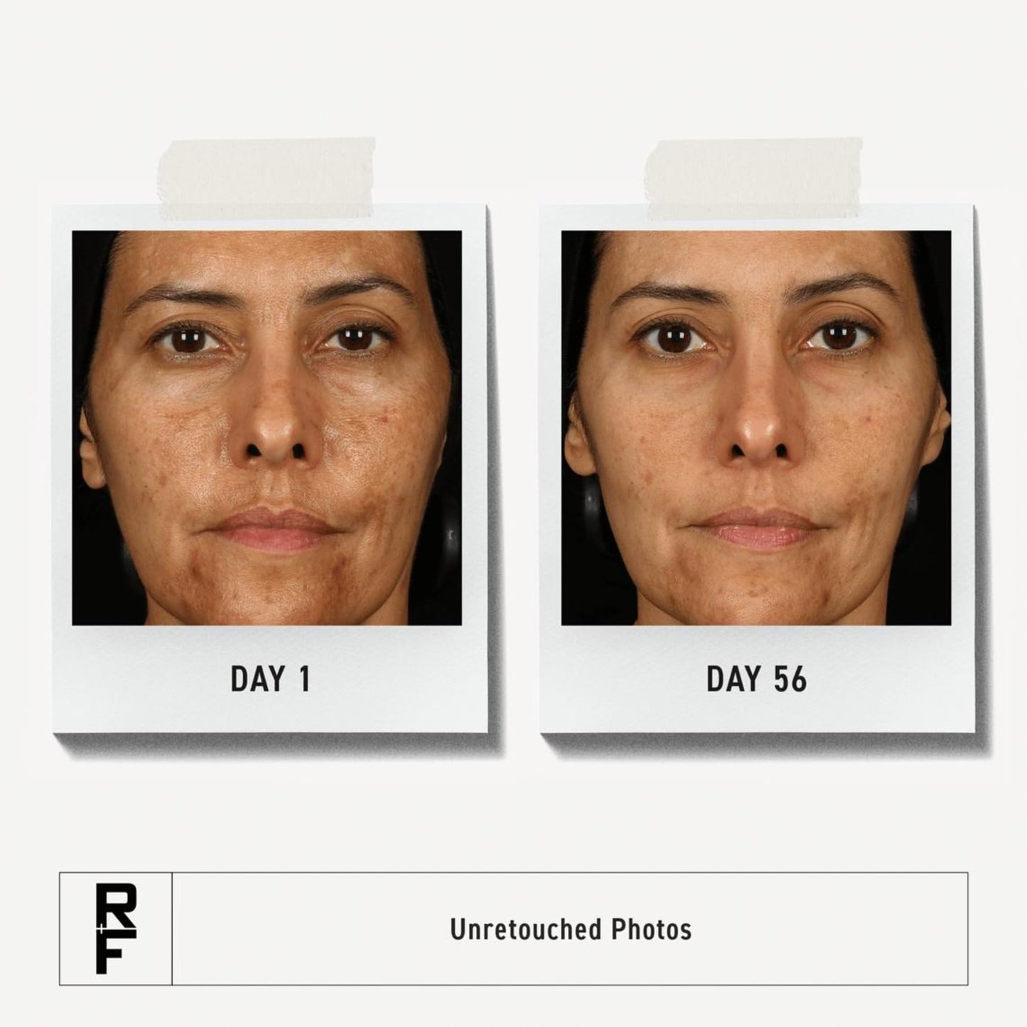 Rodan + Fields Multi-Acid Enzyme Peel | 30 ml | Formulated with Glycolic Acid & Salicylic Acid | Ideal for Uneven Skin Tone | Skin Care | Exfoliating Leave on Face Mask