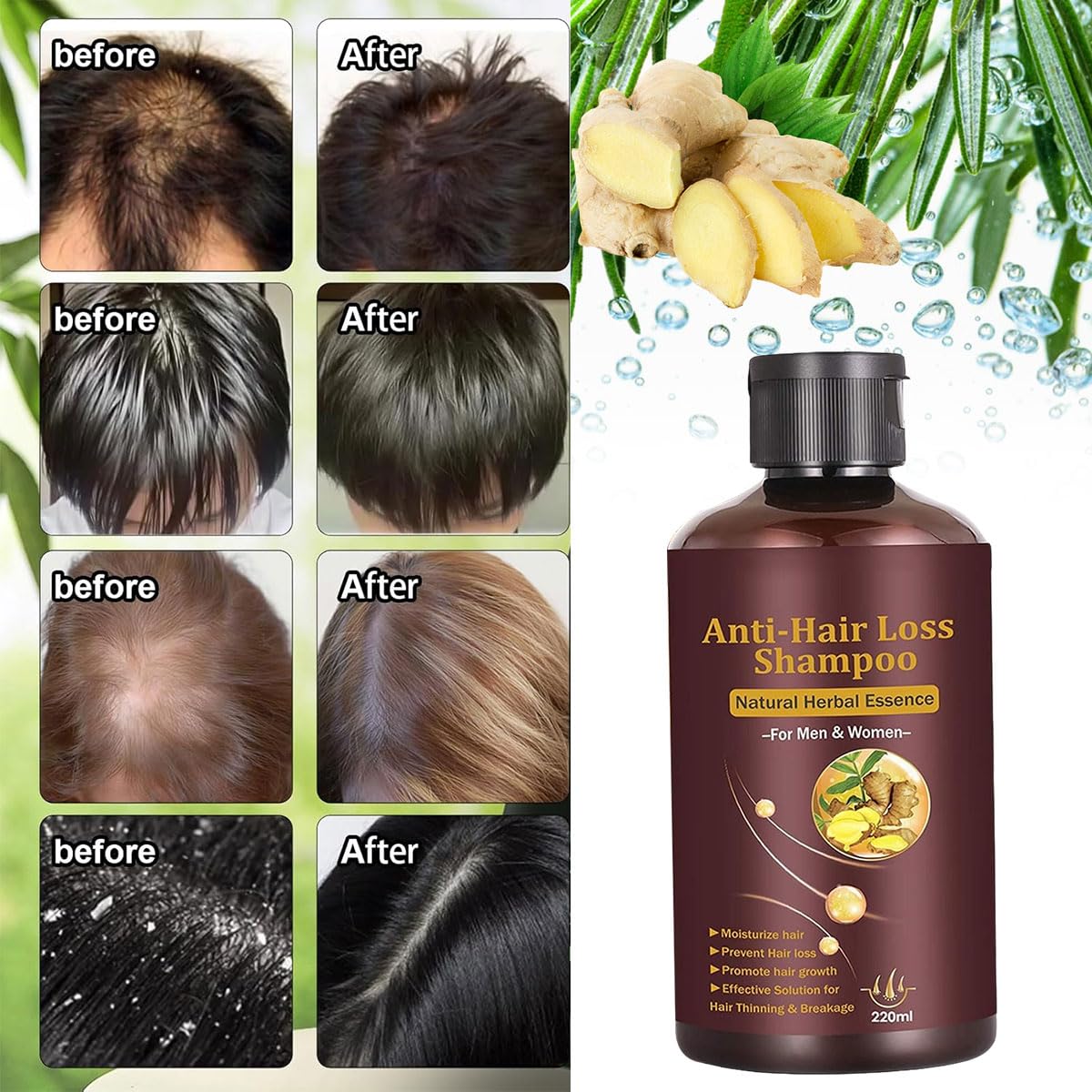 CIDBEST Hair Growth Shampoo - Anti-Thinning, Thickening Shampoo for Hair Loss & Grow Hair Fast for Men & Women, 220ML