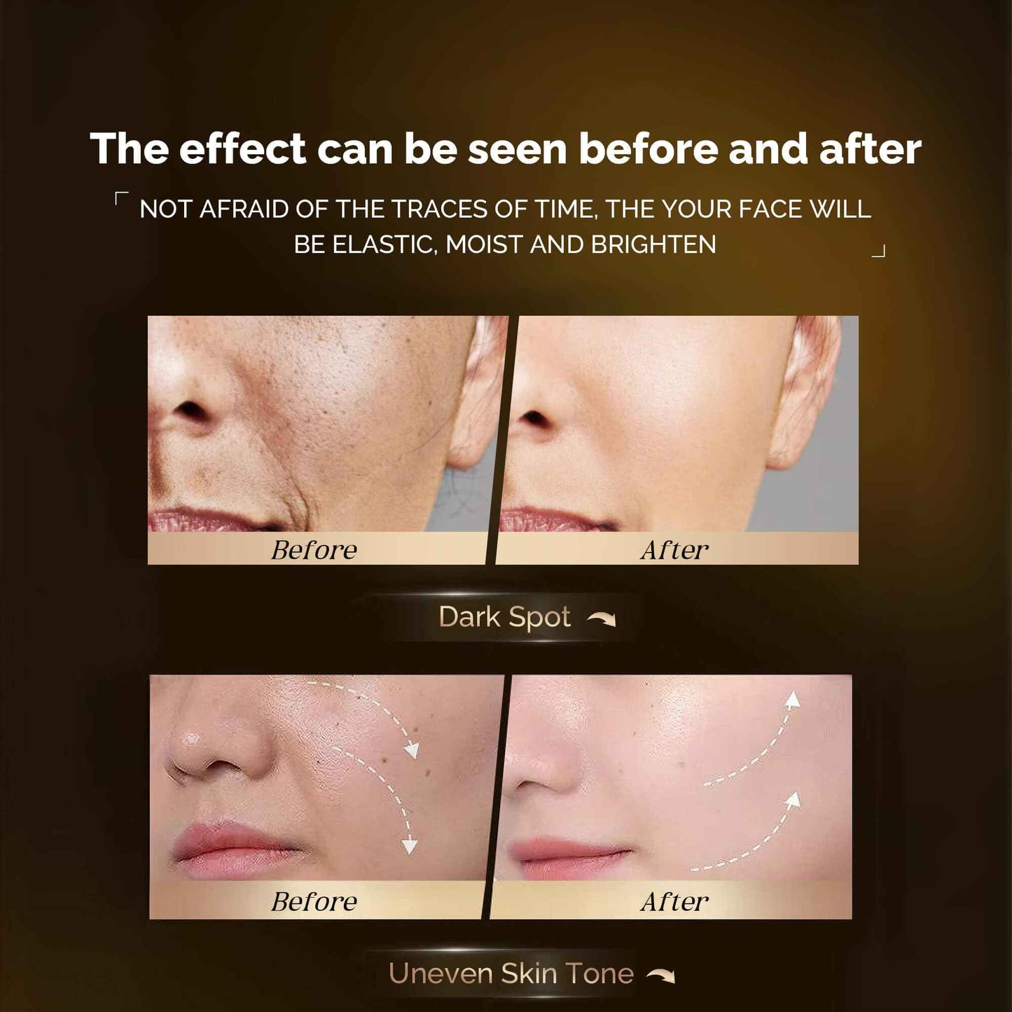 Bakuchiol Anti-Aging Serum - Fine Line & Wrinkle Reduction, 1 Fl.Oz