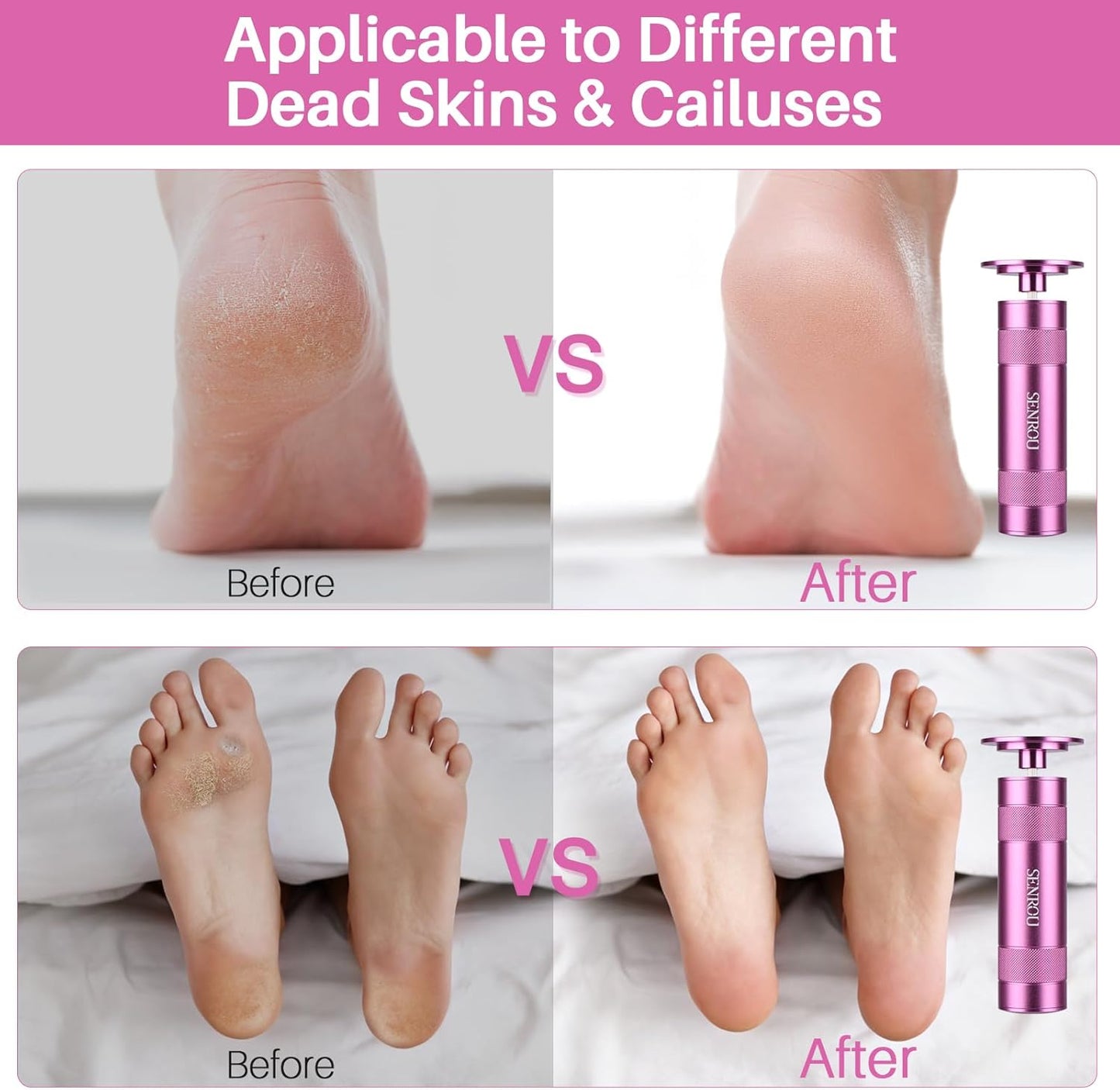 Electric Foot Callus Remover - 2-in-1 Filer with 60 Sandpaper Discs | Pink Foot Care Tool