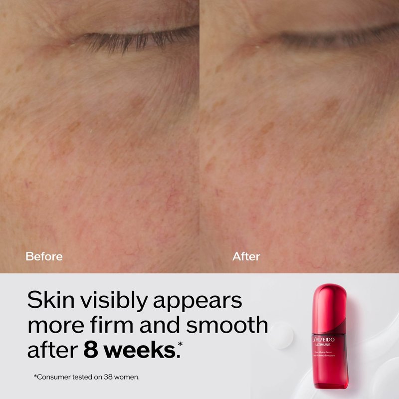 Shiseido Ultimune Power Infusing Serum - 2.5 oz - Breakthrough Lightweight Face Serum - Boosts Radiance & Improves Visible Signs of Aging - All Skin Types - Non-Comedogenic