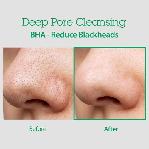 BLITHE AHA BHA Cleanser - Deep Pore Cleanser and Pore Minimizer, Exfoliant for Face, For Clogged Pores, 5.07 Fl Oz