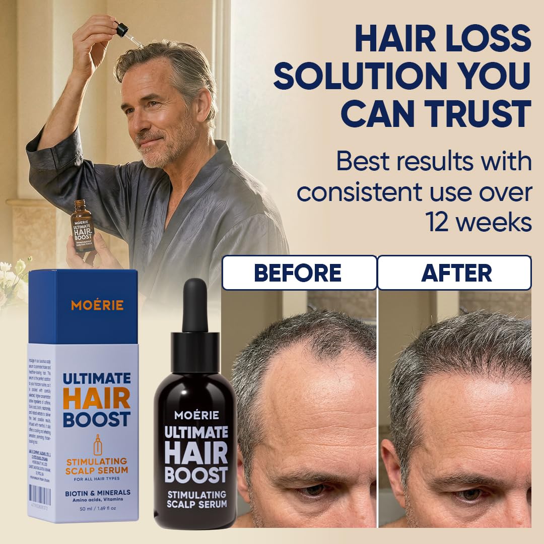 MOERIE Ultimate Hair Growth Serum for Natural Hair Regrowth & Thickening - Anti Thinning & Hair Loss Treatment for Women - Rapid Hair Growth Products - Scalp Oil Alternative - 1.69 fl oz, 2 pack