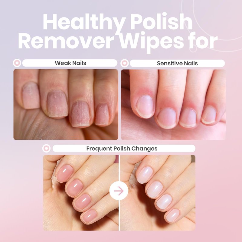 Beetles Nail Polish Remover Wipes - Non-Acetone, 50 Pack 2-in-1 Remove & Nourish Nail Polish Remover Pads - Travel Size, Individually Wrapped with Vitamin E for Quick Dry Nails Polish