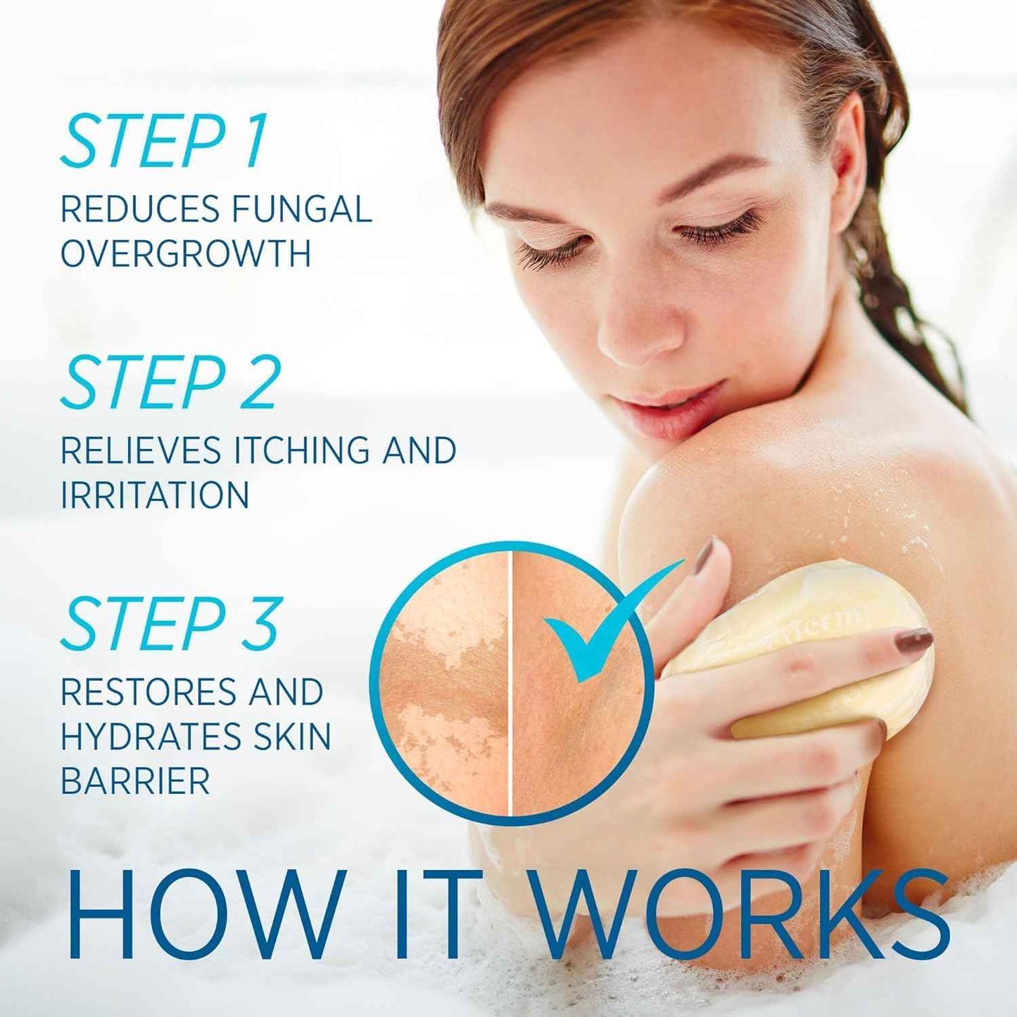 Roycederm Tinea Versicolor Relief Soap: Tea Tree Oil & Sulfur Cleansing Bar, Soothes Irritation, Hydrates & Supports Skin Health