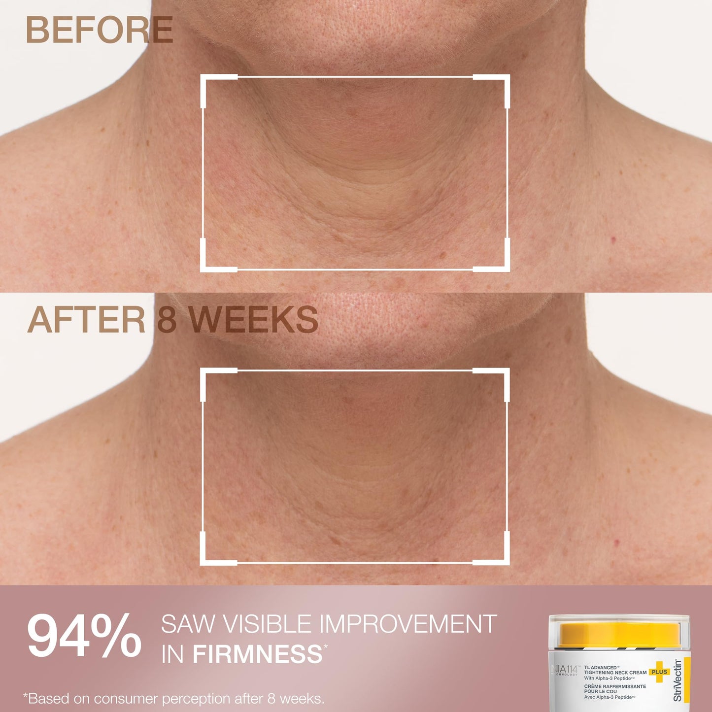 StriVectin Clinically Proven Skin Care Travel-Ready Minis 4-Piece Set