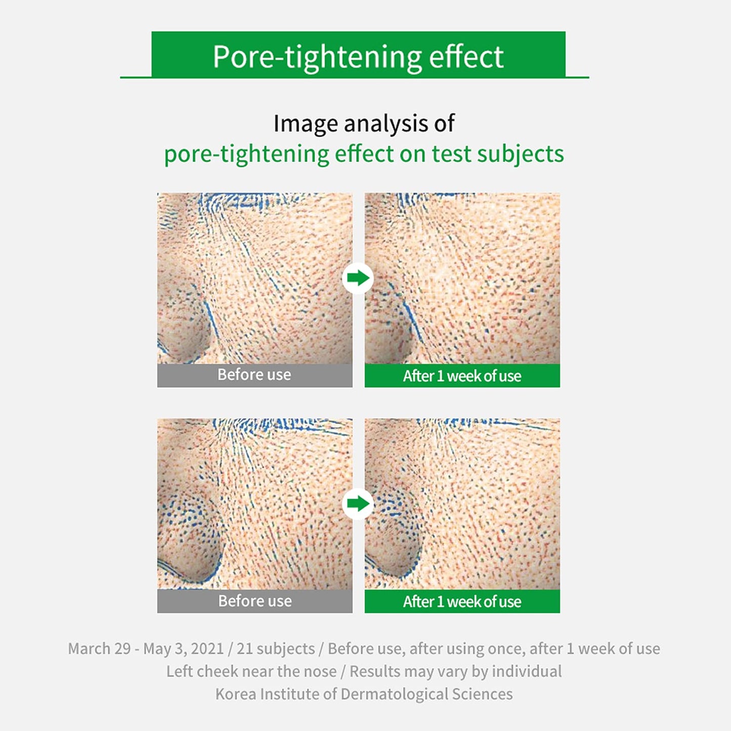 Real Cica Calming Zero Pore Toner Pads 70 Sheets Big Embo, Korean Beauty Facial Pads, Centella Asiatica, PHA, LHA, and Madecassoside, for Pore Tightening, Moisturizing, Hypoallergenic
