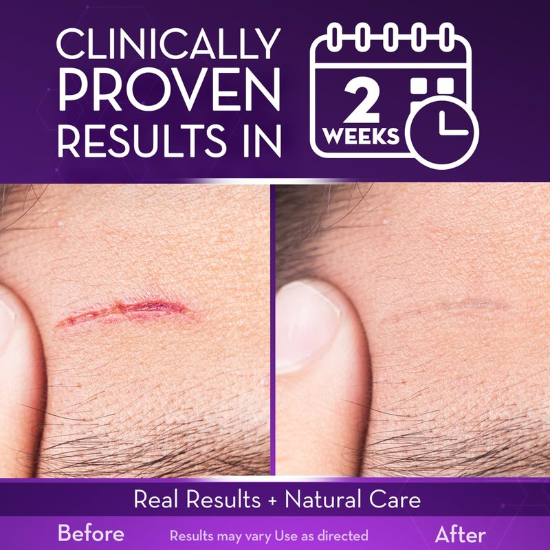 Cicatricure Advanced Scar Gel for Face & Body - Proven Results in 2 Weeks, Scar Treatment for Surgical Scars, Stretch Marks, Scars of Burns and Injuries, Acne Scar Treatment, 1 oz (28 g)
