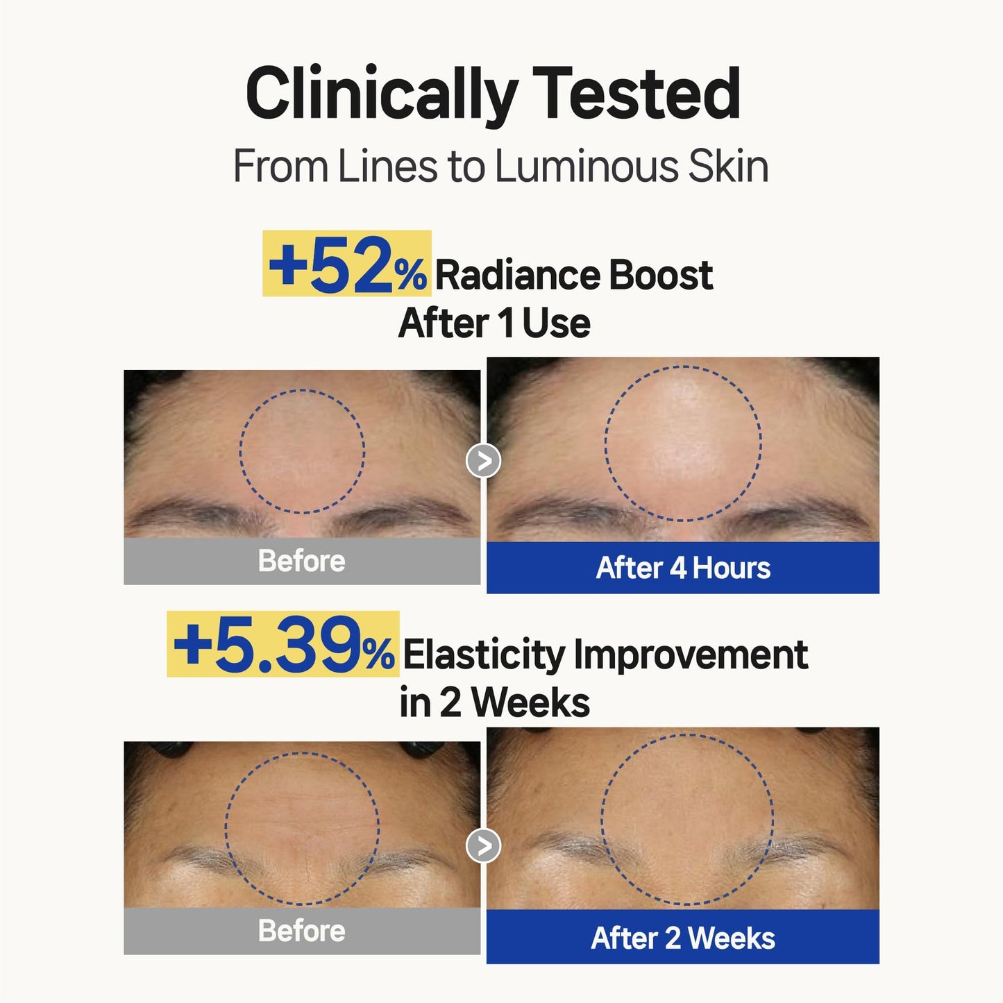 Wooshin Labottach Forehead Wrinkle Patches Overnight 12ct Korean Hydrogel Anti Wrinkle Patches with Collagen, Hyaluronic Acid and Vitamin E for Forehead Lines