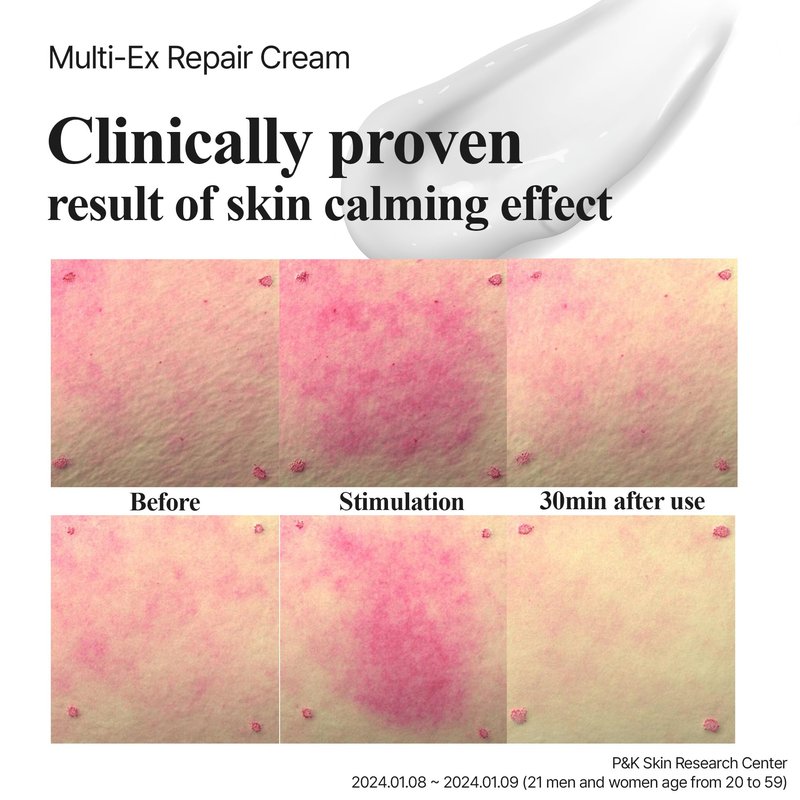 Lab for you Multi-Ex Repair Cream 100ml – Korean Face Moisturizer with Niacinamide & EGF | Skin Repair Cream for Sensitive Skin | Soothing Facial Moisturizer for Women | Hydrating Moisture