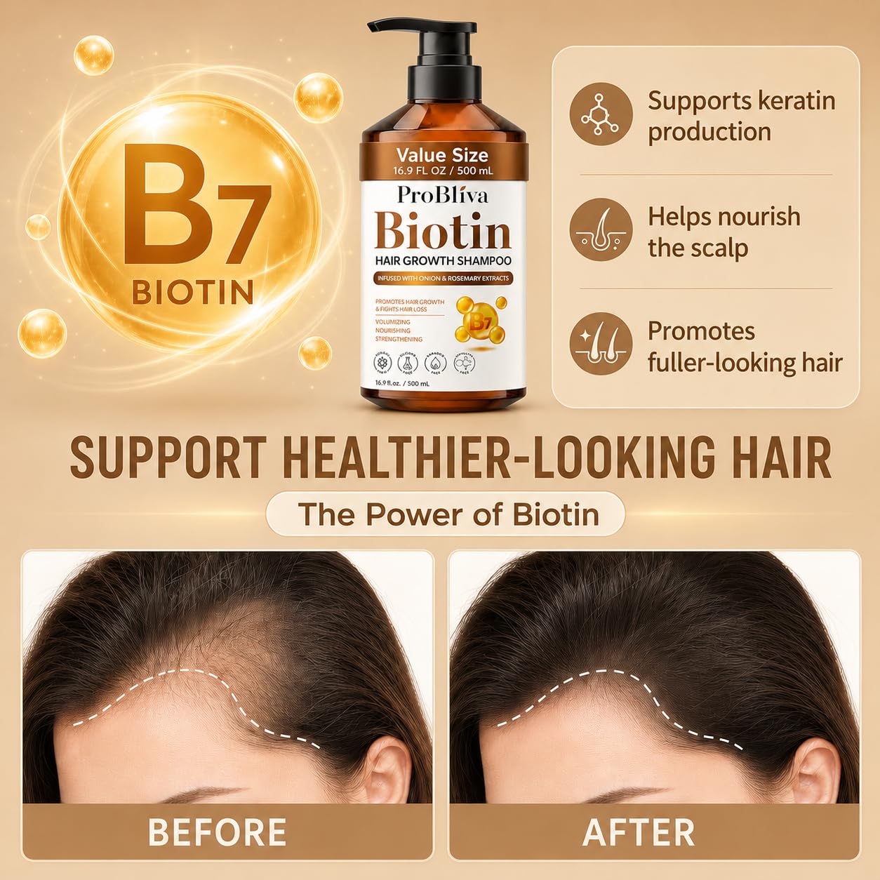 Biotin Hair Growth Shampoo for Thinning Hair in Adults 30+ – Strengthening Formula with Biotin & Rosemary – Reduces Shedding, Supports Fuller, Stronger Hair – Sulfate-Free, 16.9 fl oz