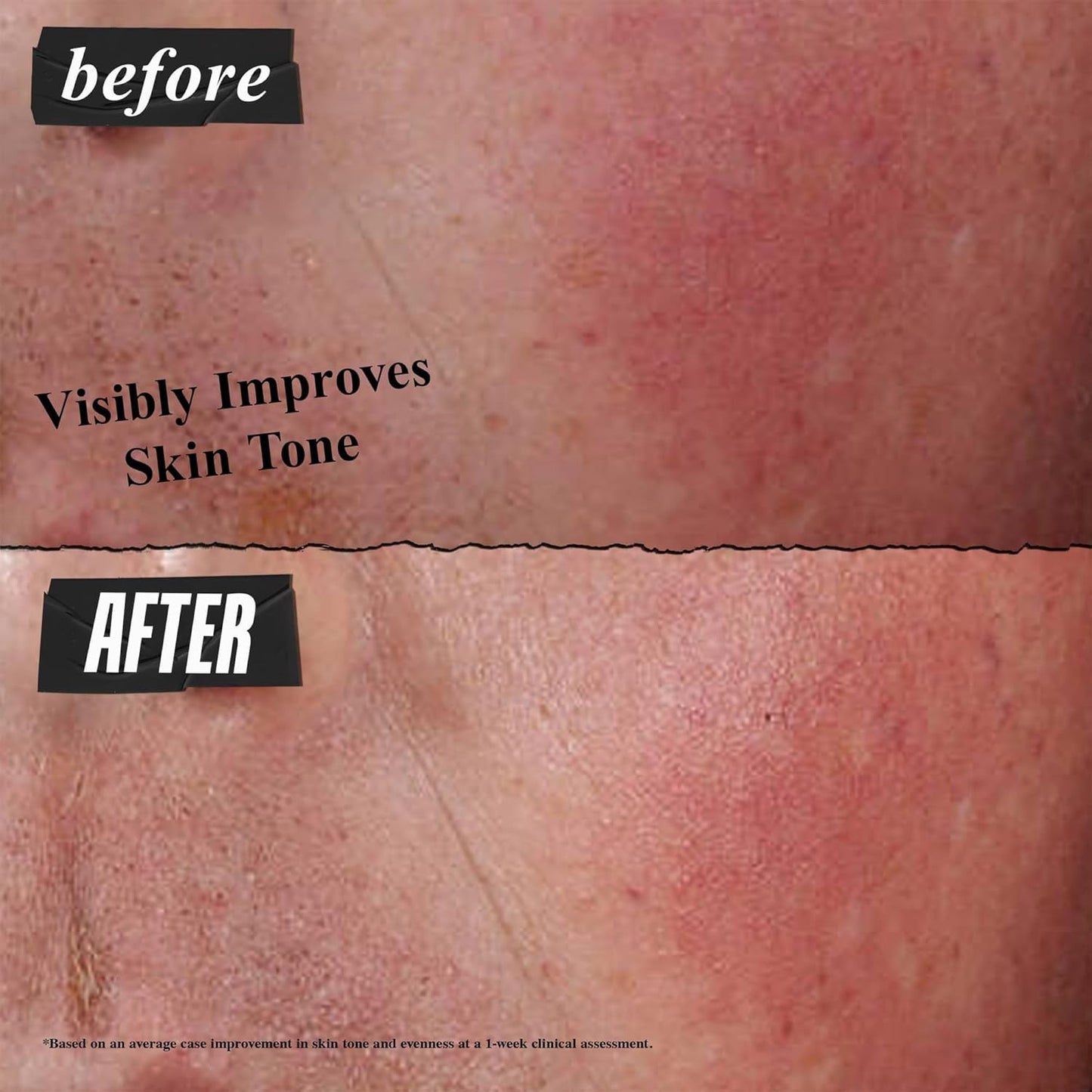 Kiehl's Ultra Facial Advanced Repair Cream - Intensive Treatment for Dry, Sensitive Skin | 1.7 fl oz