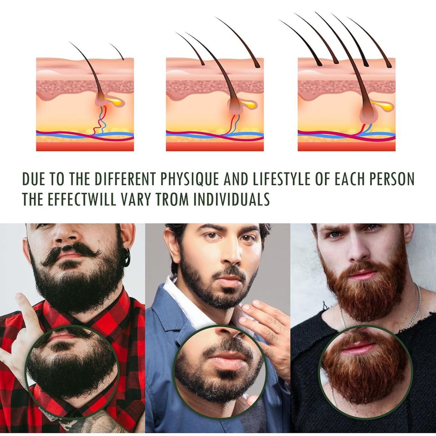 Beard Stimulating Balm - Ultra-Potent Growth Cream for Thicker, Fuller Beards | 3-Pack