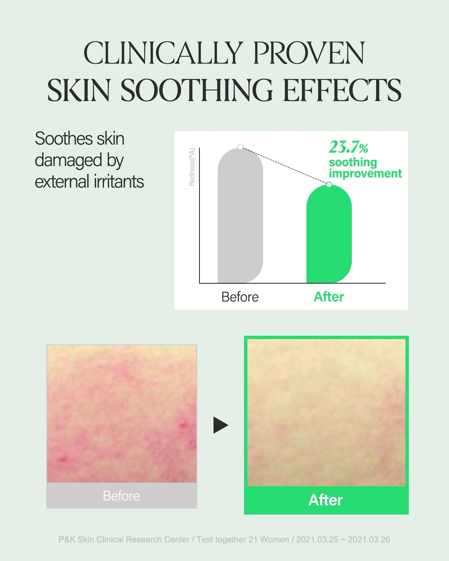 About Me SOOP Calming Aqua Serum - 53.4% Jeju Cypress Water Gel Serum with Bursting Capsules, Hydrating Face Serum for Sensitive Skin, Centella Cica & Tea Tree, Vegan Non-Sticky, 1.69 oz (50ml)