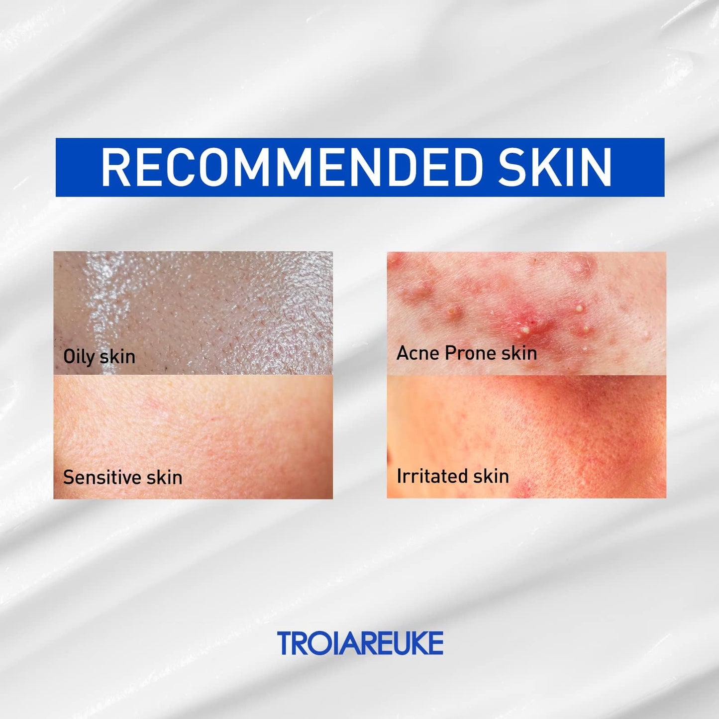 TROIAREUKE ACSEN Recovery Cream | Hydrating and Soothing Facial Moisturizer with Centella Asiatica, Olive Oil, and Squalane For Sensitive, Dry, and Dehydrated Skin, Reduces Signs of Acne Scars