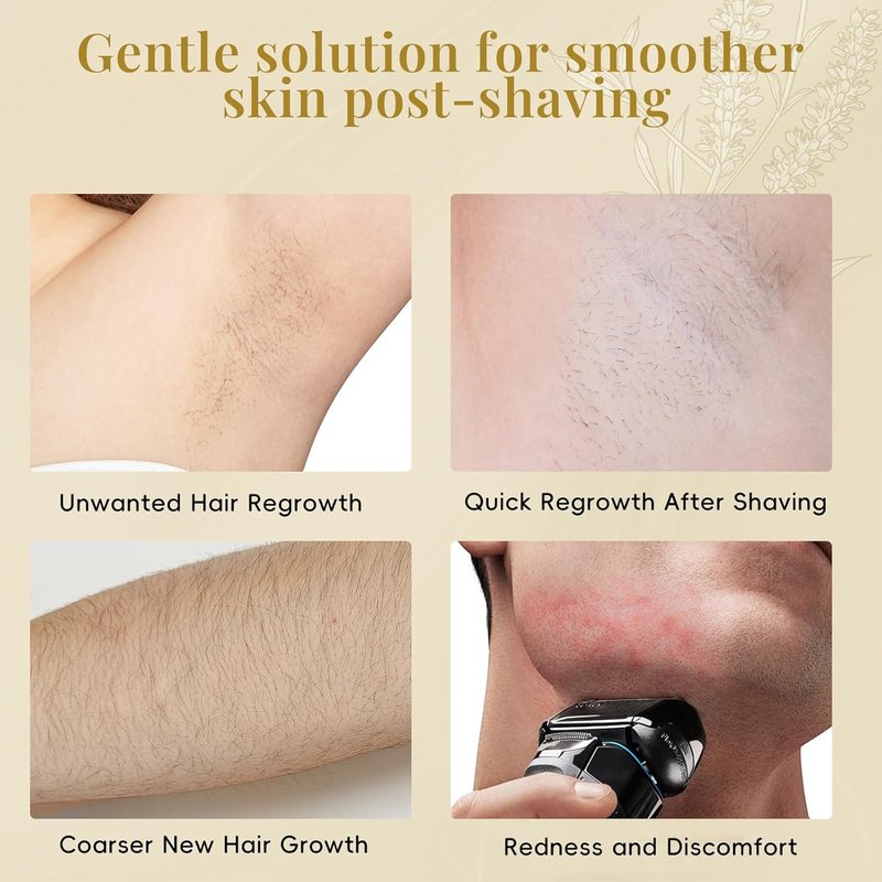 Cyperus Rotundus Serum Roll-On | Ingrown Hair & Razor Bump Treatment, Natural Growth Inhibitor for Sensitive Skin