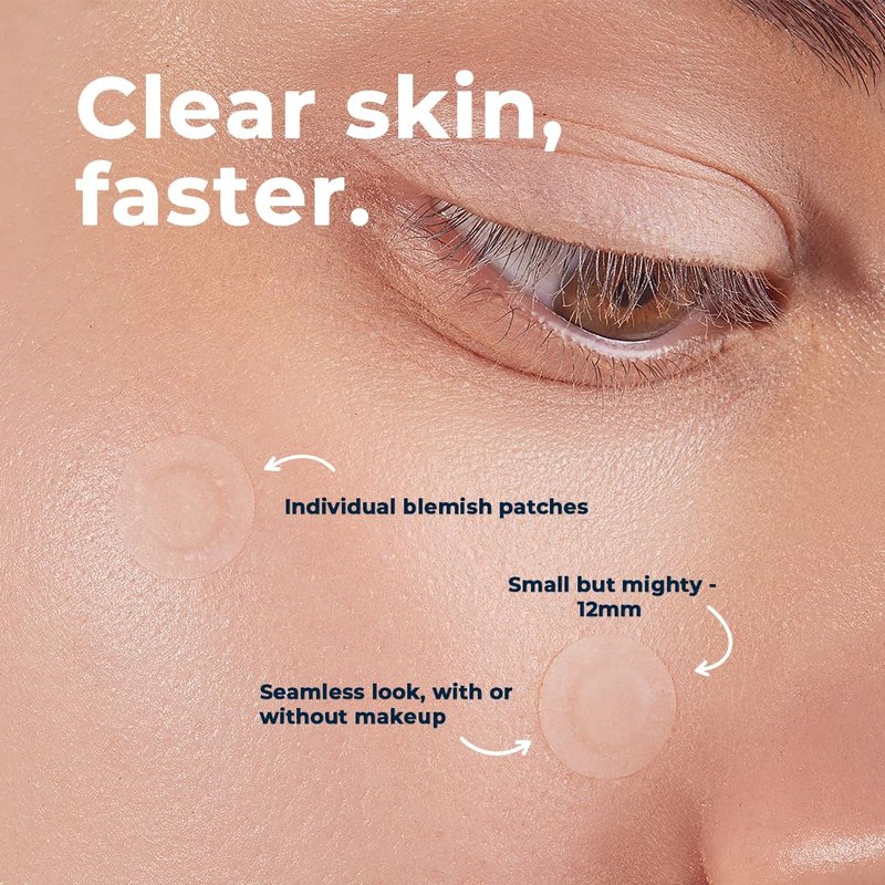 VitaMedica Clear Skin Spot Dots 6-Pack