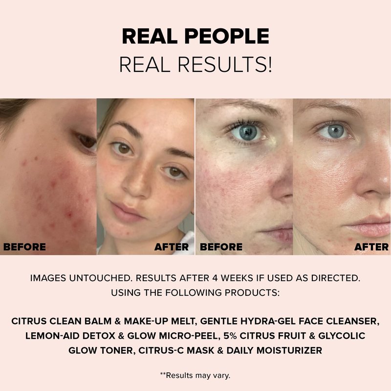 Nudestix Lemon-Aid Detox & Glow Micro-Peel – 3-in-1 Enzyme Face Exfoliator with AHAs, Vitamin C & Fruit Extracts for Bright, Smooth Skin | Clean, Vegan, Pore Detoxifying Peel