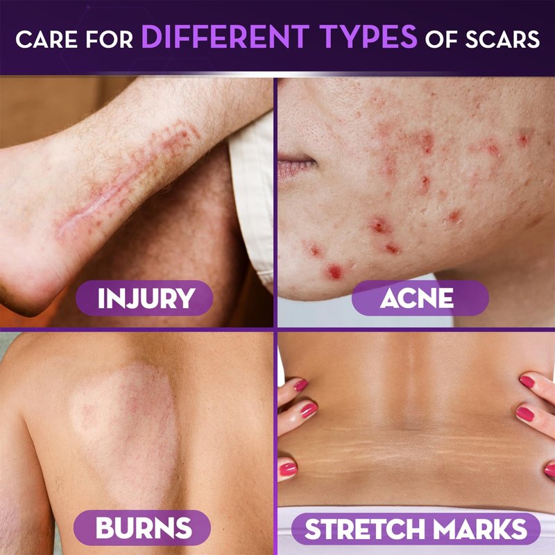 Cicatricure Advanced Scar Gel for Face & Body - Proven Results in 2 Weeks, Scar Treatment for Surgical Scars, Stretch Marks, Scars of Burns and Injuries, Acne Scar Treatment, 1 oz (28 g)