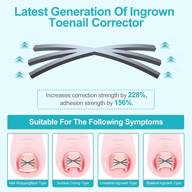 Ingrown Toenail Treatment Kit - Titanium Alloy Nail Corrector Tools with 4 Sizes | 8-Piece Set for Quick Relief