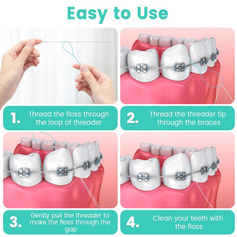 Floss Threaders, 400 Count Threaders for flossing, Dental Floss Threader for Braces, Bridges, Implants, Permanent Retainer (Pack of 4)