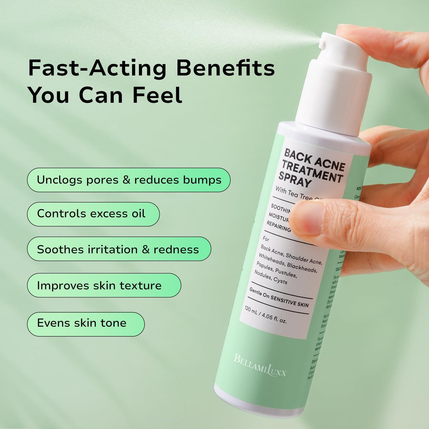 BellamiLuxx Fungal Acne Treatment Lotion: Effective Face & Body Pimple Cream for Bumps, Clusters, Itch & Redness – Fungal Prone Skin Acne Treatment Moisturizer for Teens & Adults with Natural Actives