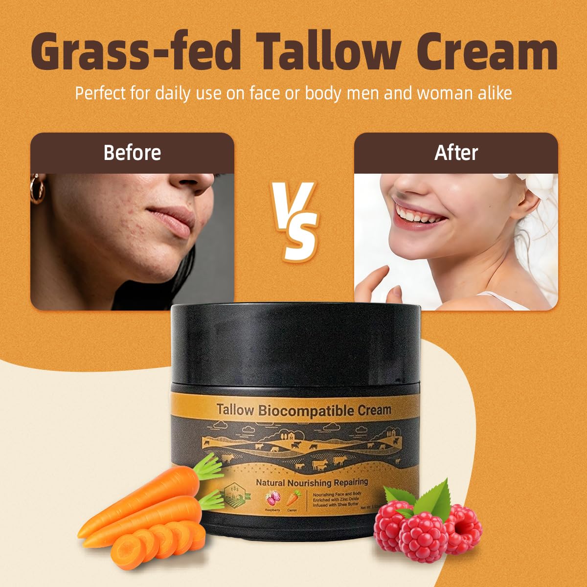 Wholly Kaw Grass-Fed Beef Tallow Face Moisturizer | Non-Nano Zinc Oxide | Unscented | Preservative Free | Odor Free | Sensitive & Dry Skin | Glass Jar 3.52 oz