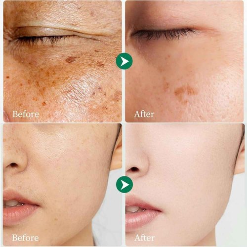 Crema para Manchas Oscuras en La Cara, Cremas para Quitar Manchas de La Cara, Crema para Las Manchas de La Cara, 50 ML / 1.7 FLOZ