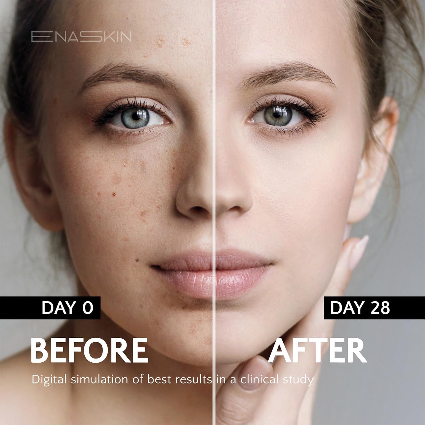 EnaSkin Dark Spot Corrector for Face & Body - 5% Tranexamic Acid, Niacinamide & Acid-Free Renewal Peptide - Hyperpigmentation, Melasma & Sun Spot Treatment, Gentle for Sensitive Skin, 1.01 fl oz